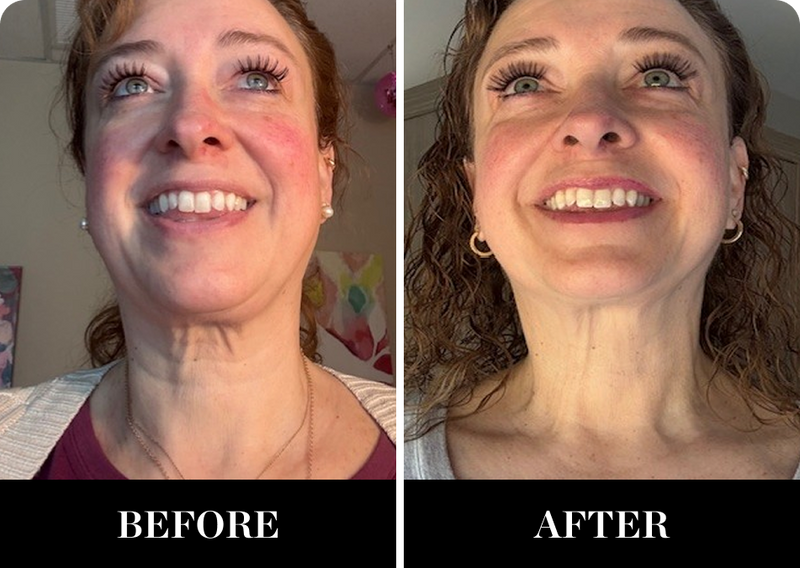 LESS WRINKLES